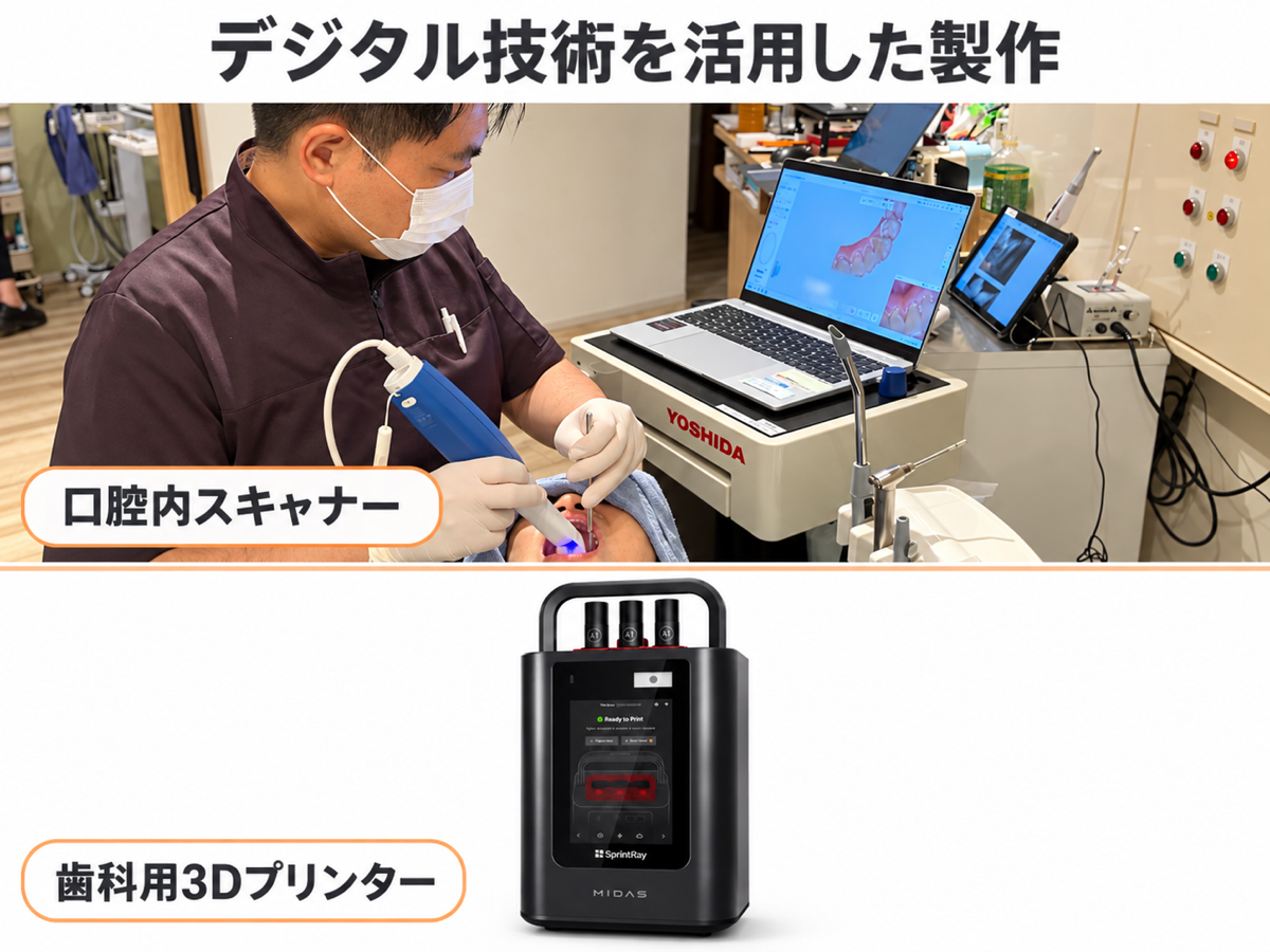 口腔内スキャナーと歯科用3Dプリンター