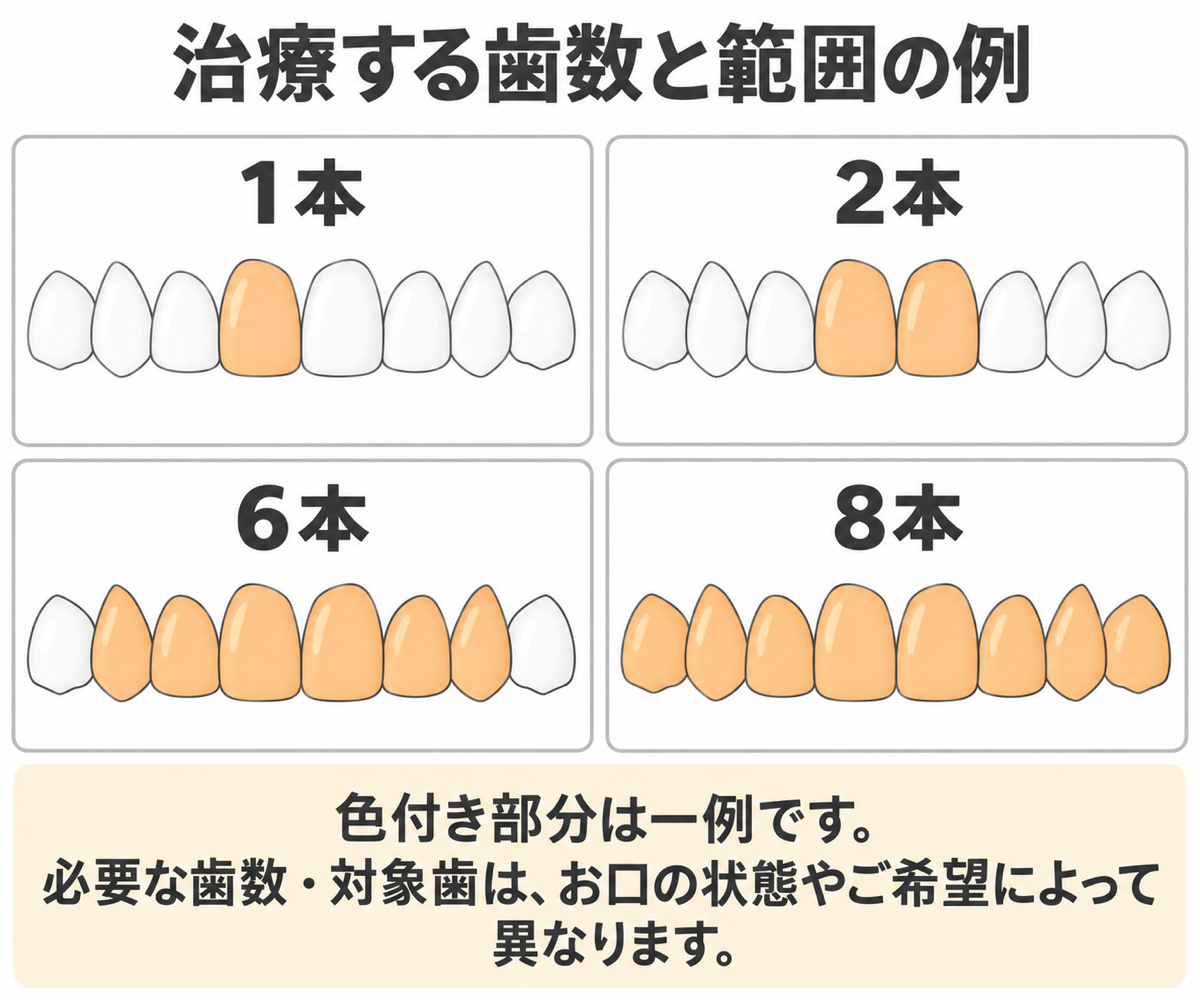 何本治療すると自然？1本・2本・6本・8本の考え方